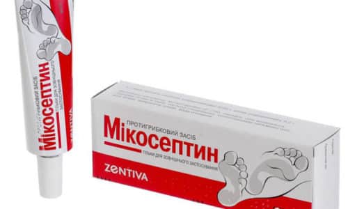 МІКОСЕПТІН – інструкція із застосування, ціна, відгуки і аналоги m kosept n nstrukc ya z zastosuvannya c na v dguki analogi 3 - МІКОСЕПТІН – інструкція із застосування, ціна, відгуки і аналоги