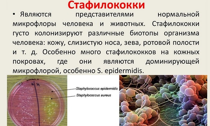 m ram stin 0 01 nstrukc ya z zastosuvannya c na v dguki analogi foto 4 - МІРАМІСТИН 0,01 – інструкція із застосування, ціна, відгуки і аналоги (фото)