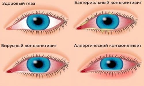 m ram stin 150 nstrukc ya z zastosuvannya c na v dguki analogi 10 - МІРАМІСТИН 150 – інструкція із застосування, ціна, відгуки і аналоги