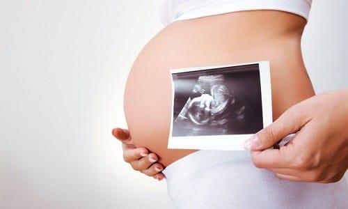 m ram stin 150 nstrukc ya z zastosuvannya c na v dguki analogi 11 - МІРАМІСТИН 150 – інструкція із застосування, ціна, відгуки і аналоги