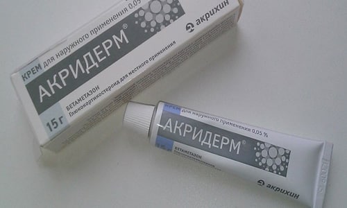 МАЗЬ або КРЕМ АКРИДЕРМ-ГК: що краще і в чому різниця (відмінність складів, відгуки лікарів) maz abo krem akriderm gk scho krasche v chomu r znicya v dm nn st sklad v v dguki l kar v 6 - МАЗЬ або КРЕМ АКРИДЕРМ-ГК: що краще і в чому різниця (відмінність складів, відгуки лікарів)