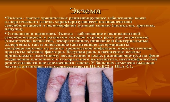 МАЗЬ або КРЕМ ТРИДЕРМ: що краще і в чому різниця (відмінність складів, відгуки лікарів) maz abo krem triderm scho krasche v chomu r znicya v dm nn st sklad v v dguki l kar v 6 - МАЗЬ або КРЕМ ТРИДЕРМ: що краще і в чому різниця (відмінність складів, відгуки лікарів)