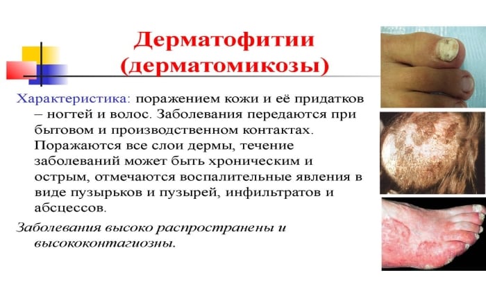 МАЗЬ або КРЕМ ТРИДЕРМ: що краще і в чому різниця (відмінність складів, відгуки лікарів) maz abo krem triderm scho krasche v chomu r znicya v dm nn st sklad v v dguki l kar v 8 - МАЗЬ або КРЕМ ТРИДЕРМ: що краще і в чому різниця (відмінність складів, відгуки лікарів)
