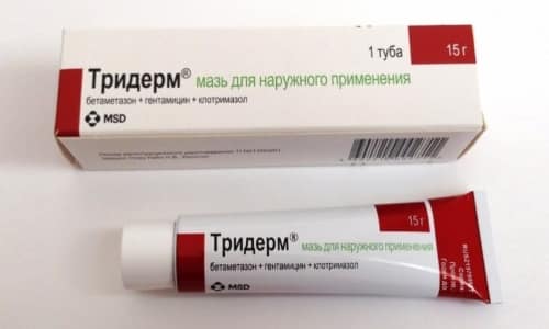 МАЗЬ або КРЕМ ТРИДЕРМ: що краще і в чому різниця (відмінність складів, відгуки лікарів) maz abo krem triderm scho krasche v chomu r znicya v dm nn st sklad v v dguki l kar v 9 - МАЗЬ або КРЕМ ТРИДЕРМ: що краще і в чому різниця (відмінність складів, відгуки лікарів)
