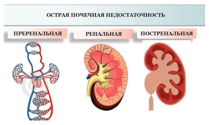 МЕТРОГІЛ 100 – інструкція із застосування, ціна, відгуки і аналоги metrog l 100 nstrukc ya z zastosuvannya c na v dguki analogi 2 - МЕТРОГІЛ 100 – інструкція із застосування, ціна, відгуки і аналоги