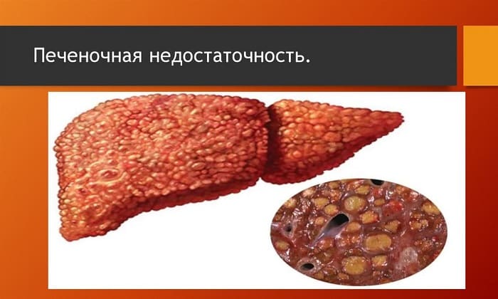 МЕТРОНІДАЗОЛ 250 – інструкція із застосування, ціна, відгуки і аналоги metron dazol 250 nstrukc ya z zastosuvannya c na v dguki analogi 13 - МЕТРОНІДАЗОЛ 250 – інструкція із застосування, ціна, відгуки і аналоги