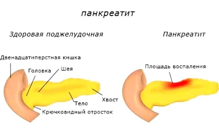 МЕТРОНІДАЗОЛ 250 – інструкція із застосування, ціна, відгуки і аналоги metron dazol 250 nstrukc ya z zastosuvannya c na v dguki analogi 16 - МЕТРОНІДАЗОЛ 250 – інструкція із застосування, ціна, відгуки і аналоги