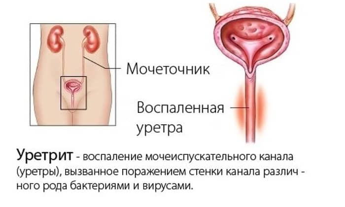 МЕТРОНІДАЗОЛ 250 – інструкція із застосування, ціна, відгуки і аналоги metron dazol 250 nstrukc ya z zastosuvannya c na v dguki analogi 6 - МЕТРОНІДАЗОЛ 250 – інструкція із застосування, ціна, відгуки і аналоги