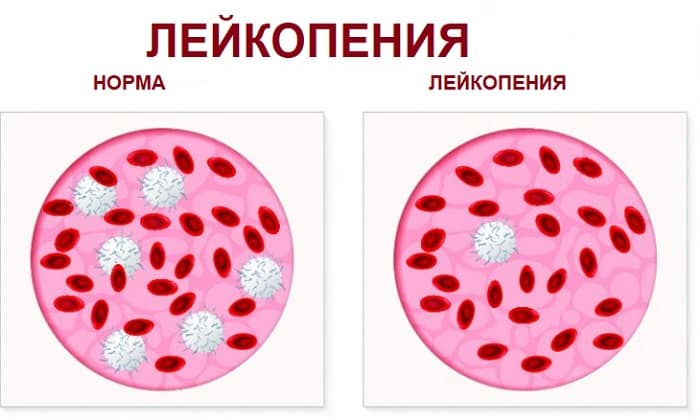 МЕТРОНІДАЗОЛ НІКОМЕД – інструкція із застосування, ціна, відгуки і аналоги metron dazol n komed nstrukc ya z zastosuvannya c na v dguki analogi 17 - МЕТРОНІДАЗОЛ НІКОМЕД – інструкція із застосування, ціна, відгуки і аналоги