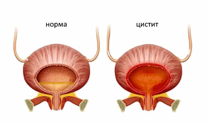 МЕТРОНІДАЗОЛ НІКОМЕД – інструкція із застосування, ціна, відгуки і аналоги metron dazol n komed nstrukc ya z zastosuvannya c na v dguki analogi 31 - МЕТРОНІДАЗОЛ НІКОМЕД – інструкція із застосування, ціна, відгуки і аналоги