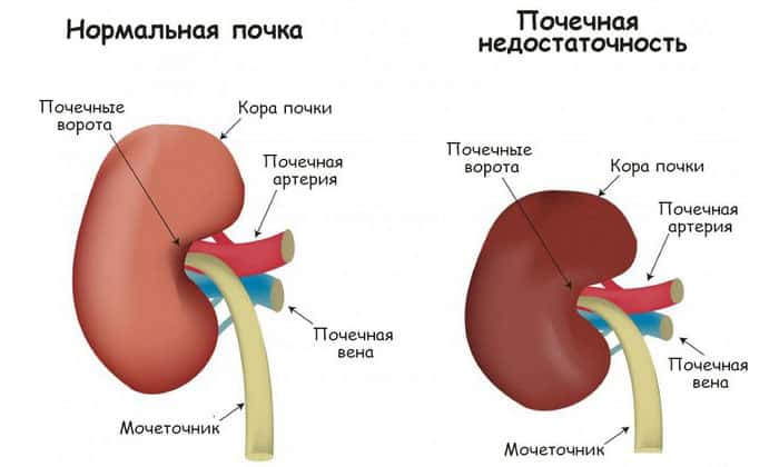МЕТРОНІДАЗОЛ НІКОМЕД – інструкція із застосування, ціна, відгуки і аналоги metron dazol n komed nstrukc ya z zastosuvannya c na v dguki analogi 34 - МЕТРОНІДАЗОЛ НІКОМЕД – інструкція із застосування, ціна, відгуки і аналоги