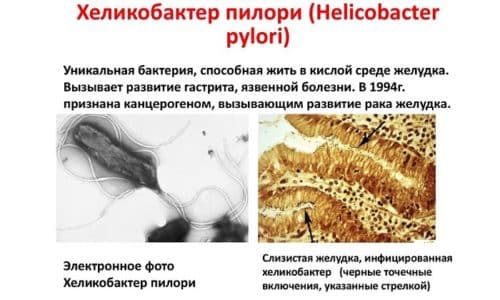МЕТРОНІДАЗОЛ НІКОМЕД – інструкція із застосування, ціна, відгуки і аналоги metron dazol n komed nstrukc ya z zastosuvannya c na v dguki analogi 5 - МЕТРОНІДАЗОЛ НІКОМЕД – інструкція із застосування, ціна, відгуки і аналоги