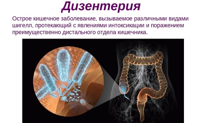 МЕТРОНІДАЗОЛ НІКОМЕД – інструкція із застосування, ціна, відгуки і аналоги metron dazol n komed nstrukc ya z zastosuvannya c na v dguki analogi 6 - МЕТРОНІДАЗОЛ НІКОМЕД – інструкція із застосування, ціна, відгуки і аналоги
