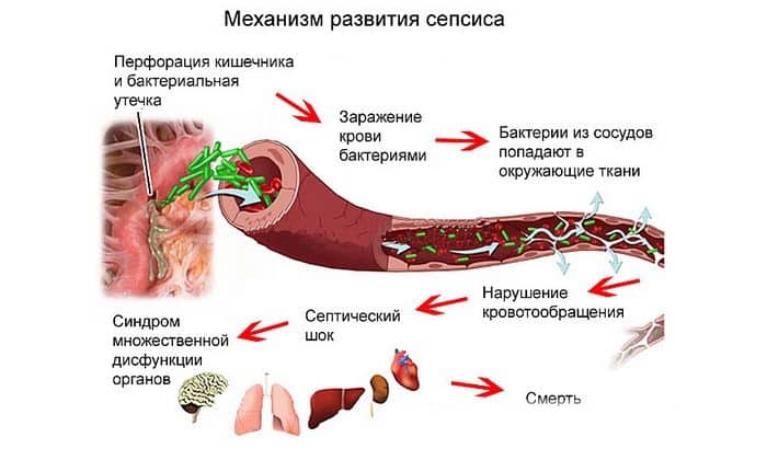 МЕТРОНІДАЗОЛ НІКОМЕД – інструкція із застосування, ціна, відгуки і аналоги metron dazol n komed nstrukc ya z zastosuvannya c na v dguki analogi 8 - МЕТРОНІДАЗОЛ НІКОМЕД – інструкція із застосування, ціна, відгуки і аналоги