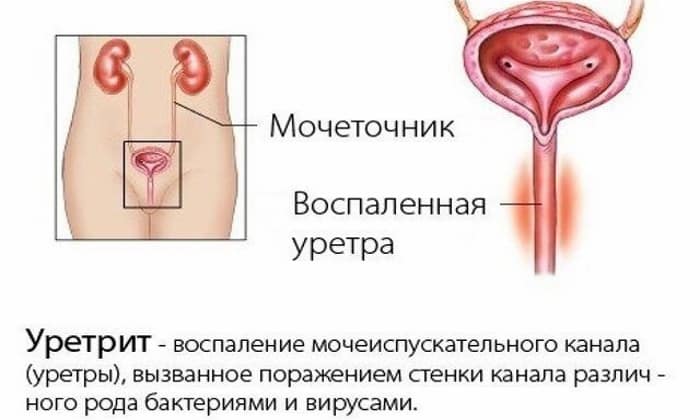 МЕТРОНІДАЗОЛ НІКОМЕД – інструкція із застосування, ціна, відгуки і аналоги metron dazol n komed nstrukc ya z zastosuvannya c na v dguki analogi 9 - МЕТРОНІДАЗОЛ НІКОМЕД – інструкція із застосування, ціна, відгуки і аналоги