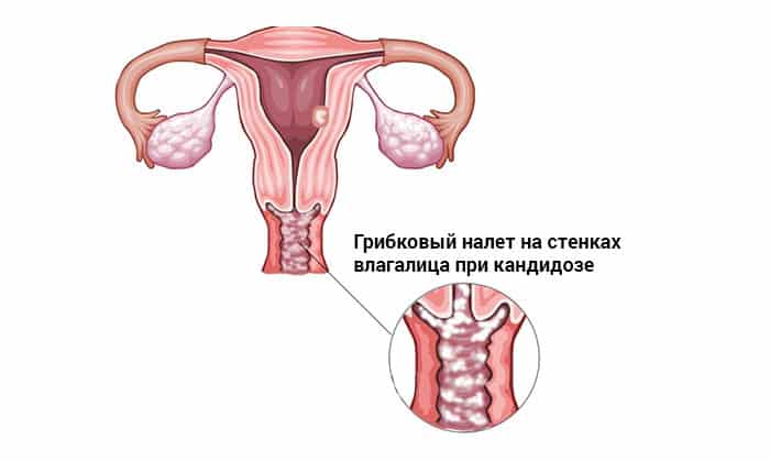 МИФУНГАР – інструкція із застосування, ціна, відгуки і аналоги mifungar nstrukc ya z zastosuvannya c na v dguki analogi 3 - МИФУНГАР – інструкція із застосування, ціна, відгуки і аналоги