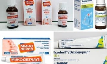 МИКОДЕРИЛ або ЭКЗОДЕРИЛ: що краще і в чому різниця (відмінність складів, відгуки лікарів) mikoderil abo ekzoderil scho krasche v chomu r znicya v dm nn st sklad v v dguki l kar v 1 - МИКОДЕРИЛ або ЭКЗОДЕРИЛ: що краще і в чому різниця (відмінність складів, відгуки лікарів)