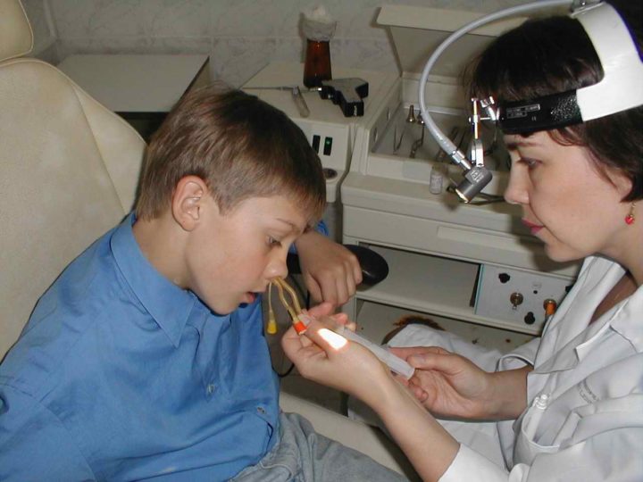 mukov scidoz u d tey novonarodzhenih scho ce za hvoroba oznaki simptomi prichini d agnostika ta l kuvannya z foto 17 - Муковісцидоз у дітей і новонароджених – що це за хвороба, ознаки, симптоми і причини, діагностика та лікування з фото