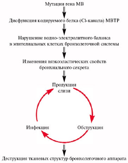 mukov scidoz u d tey novonarodzhenih scho ce za hvoroba oznaki simptomi prichini d agnostika ta l kuvannya z foto 8 - Муковісцидоз у дітей і новонароджених – що це за хвороба, ознаки, симптоми і причини, діагностика та лікування з фото