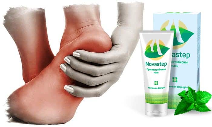 NOVASTEP ГРИБКА: відгуки, ціна, склад і чи варто купувати novastep gribka v dguki c na sklad chi varto kupuvati 3 - NOVASTEP ГРИБКА: відгуки, ціна, склад і чи варто купувати