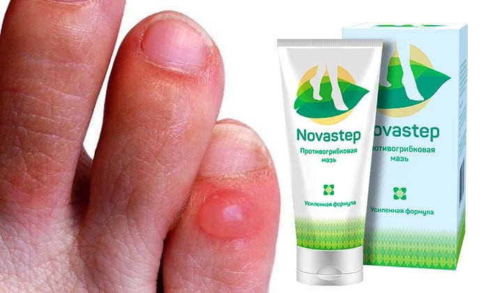 NOVASTEP ГРИБКА: відгуки, ціна, склад і чи варто купувати novastep gribka v dguki c na sklad chi varto kupuvati 5 - NOVASTEP ГРИБКА: відгуки, ціна, склад і чи варто купувати