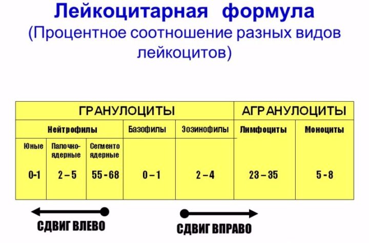 osnovn simptomi ta metodi d agnostiki pnevmon zapalennya legen v u d tey 6 - Основні симптоми та методи діагностики пневмонії (запалення легенів) у дітей