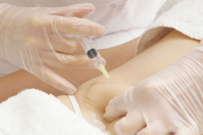 ozonoterap ya pri vag tnost vnutr shn ovenno pokazannya ta protipokazannya efekt pr 2 - Озонотерапія при вагітності (внутрішньовенно): показання та протипоказання, ефект і пр