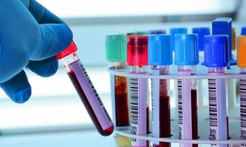 Підшлункова залоза при цукровому діабеті (у чоловіків, жінок, людей похилого віку, підлітків і дітей): типи, причини, симптоми, діагностика, лікування та ускладнення p dshlunkova zaloza pri cukrovomu d abet u cholov k v zh nok lyudey pohilogo v ku p dl tk v d tey tipi prichini simptomi d agnostika l kuvannya ta uskladnennya 7 - Підшлункова залоза при цукровому діабеті (у чоловіків, жінок, людей похилого віку, підлітків і дітей): типи, причини, симптоми, діагностика, лікування та ускладнення
