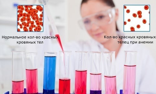 Париет 20 – інструкція по застосуванню pariet 20 nstrukc ya po zastosuvannyu 3 - Париет 20 – інструкція по застосуванню