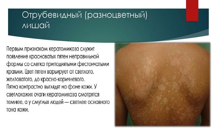 ПЕРХОТАЛ – інструкція із застосування, ціна, відгуки і аналоги perhotal nstrukc ya z zastosuvannya c na v dguki analogi 6 - ПЕРХОТАЛ – інструкція із застосування, ціна, відгуки і аналоги