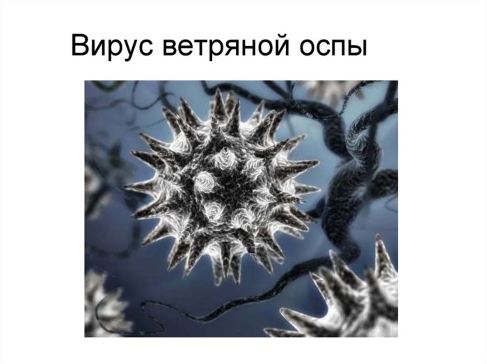 prof laktika v tryano v spi u doroslih ta d tey yak mozhna zarazitisya nkubac yniy per od zarazn st zahvoryuvannya 3 - Профілактика вітряної віспи у дорослих та дітей: як можна заразитися, інкубаційний період і заразність захворювання