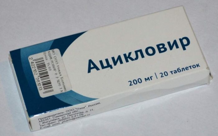 prof laktika v tryano v spi u doroslih ta d tey yak mozhna zarazitisya nkubac yniy per od zarazn st zahvoryuvannya 5 - Профілактика вітряної віспи у дорослих та дітей: як можна заразитися, інкубаційний період і заразність захворювання