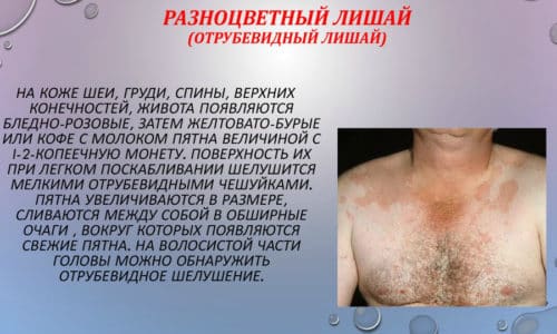 ПРОКАНАЗОЛ – інструкція із застосування, ціна, відгуки і аналоги prokanazol nstrukc ya z zastosuvannya c na v dguki analogi 8 - ПРОКАНАЗОЛ – інструкція із застосування, ціна, відгуки і аналоги