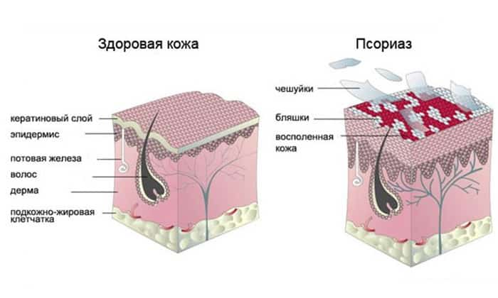 РЕДЕРМ – інструкція із застосування, ціна, відгуки і аналоги rederm nstrukc ya z zastosuvannya c na v dguki analogi 1 - РЕДЕРМ – інструкція із застосування, ціна, відгуки і аналоги