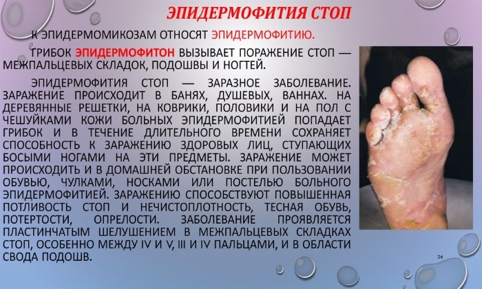 СПРЕЙ ТЕРБІНАФІН – інструкція із застосування, ціна, відгуки і аналоги sprey terb naf n nstrukc ya z zastosuvannya c na v dguki analogi 3 - СПРЕЙ ТЕРБІНАФІН – інструкція із застосування, ціна, відгуки і аналоги