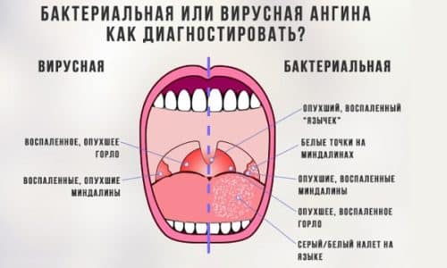 Сухість і гіркота в роті (у жінок, які при вагітності): причини виникнення, характер прояви, діагностика, лікування та профілактика suh st g rkota v rot u zh nok yak pri vag tnost prichini viniknennya harakter proyavi d agnostika l kuvannya ta prof laktika 1 - Сухість і гіркота в роті (у жінок, які при вагітності): причини виникнення, характер прояви, діагностика, лікування та профілактика
