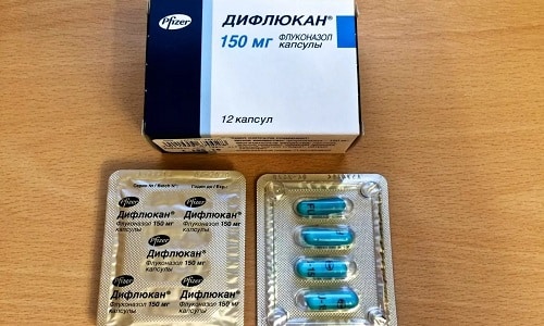 СВІЧКИ ДИФЛЮКАН – інструкція із застосування, ціна, відгуки і аналоги sv chki diflyukan nstrukc ya z zastosuvannya c na v dguki analogi 1 - СВІЧКИ ДИФЛЮКАН – інструкція із застосування, ціна, відгуки і аналоги