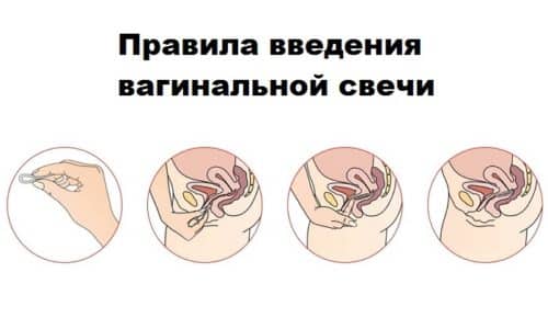 sv chki ketokonazol nstrukc ya z zastosuvannya c na v dguki analogi 3 - СВІЧКИ КЕТОКОНАЗОЛ – інструкція із застосування, ціна, відгуки і аналоги