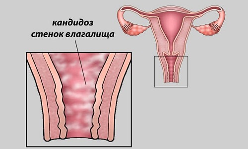 tabletki dermazol nstrukc ya z zastosuvannya c na v dguki analogi 6 - ТАБЛЕТКИ ДЕРМАЗОЛ – інструкція із застосування, ціна, відгуки і аналоги