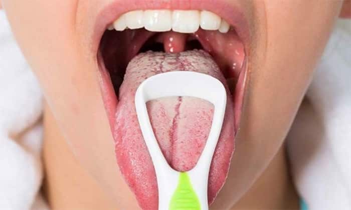 tabletki flukonazol nstrukc ya z zastosuvannya c na v dguki analogi 6 - ТАБЛЕТКИ ФЛУКОНАЗОЛ – інструкція із застосування, ціна, відгуки і аналоги