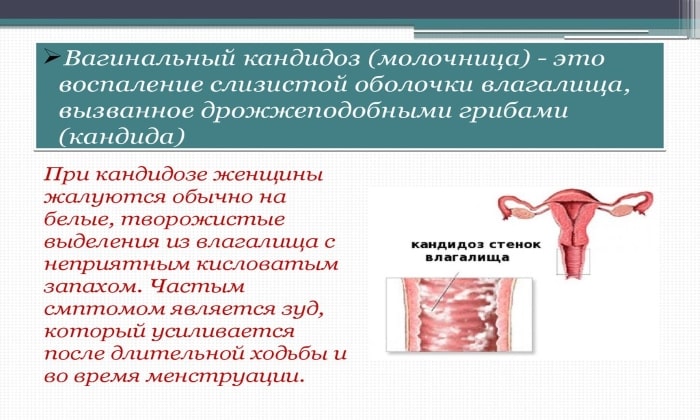 tabletki kandid nstrukc ya z zastosuvannya c na v dguki analogi 3 - ТАБЛЕТКИ КАНДИД – інструкція із застосування, ціна, відгуки і аналоги
