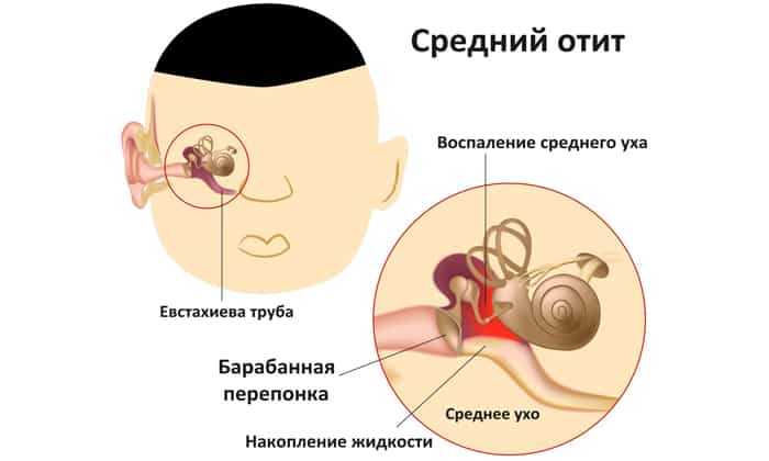 tabletki m ram stin nstrukc ya z zastosuvannya c na v dguki analogi 3 - ТАБЛЕТКИ МІРАМІСТИН – інструкція із застосування, ціна, відгуки і аналоги