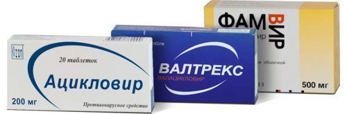 tabletki v d gerpesu na gubah prof laktika l kuvannya maz 1 - Таблетки від герпесу на губах: профілактика, лікування, мазі