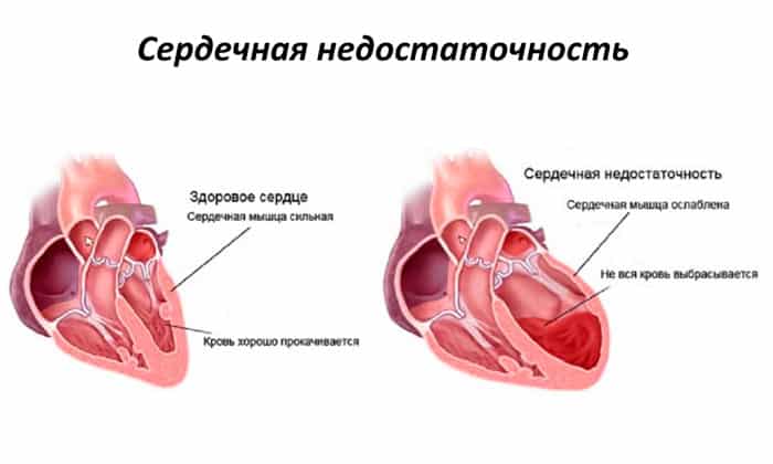 teknazol nstrukc ya z zastosuvannya c na v dguki analogi 12 - ТЕКНАЗОЛ – інструкція із застосування, ціна, відгуки і аналоги