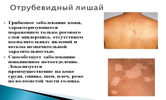 teknazol nstrukc ya z zastosuvannya c na v dguki analogi 2 - ТЕКНАЗОЛ – інструкція із застосування, ціна, відгуки і аналоги