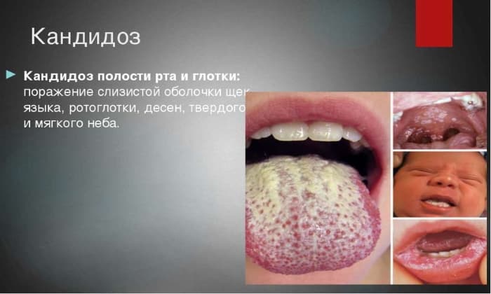 teknazol nstrukc ya z zastosuvannya c na v dguki analogi 3 - ТЕКНАЗОЛ – інструкція із застосування, ціна, відгуки і аналоги