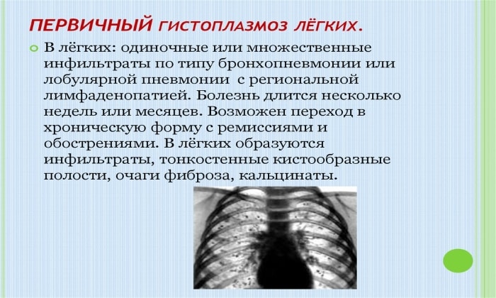 teknazol nstrukc ya z zastosuvannya c na v dguki analogi 6 - ТЕКНАЗОЛ – інструкція із застосування, ціна, відгуки і аналоги