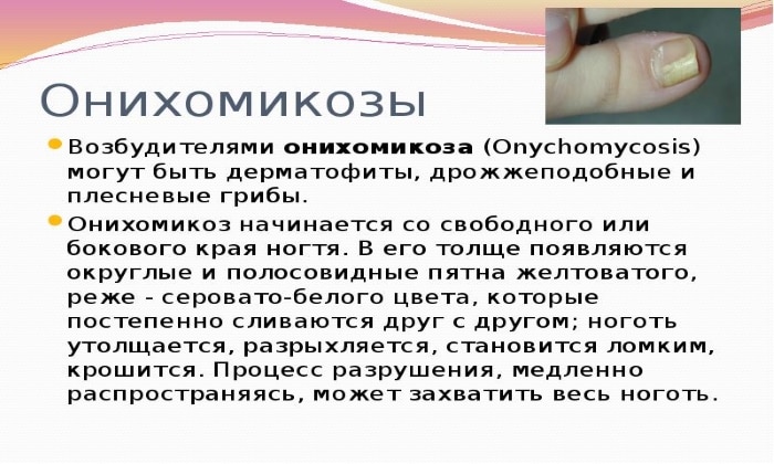 ТЕРБІНАФІН 250 – інструкція із застосування, ціна, відгуки і аналоги terb naf n 250 nstrukc ya z zastosuvannya c na v dguki analogi 5 - ТЕРБІНАФІН 250 – інструкція із застосування, ціна, відгуки і аналоги