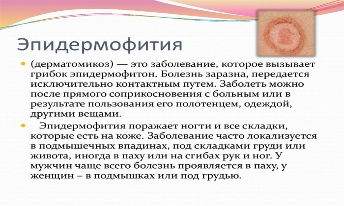 ТЕРБІНАФІН 250 – інструкція із застосування, ціна, відгуки і аналоги terb naf n 250 nstrukc ya z zastosuvannya c na v dguki analogi 7 - ТЕРБІНАФІН 250 – інструкція із застосування, ціна, відгуки і аналоги