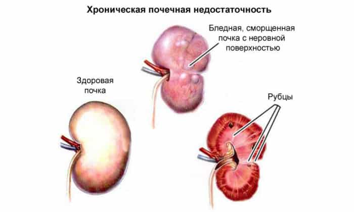 ТЕРБІНАФІН-ТЕВА – інструкція із застосування, ціна, відгуки і аналоги terb naf n teva nstrukc ya z zastosuvannya c na v dguki analogi 7 - ТЕРБІНАФІН-ТЕВА – інструкція із застосування, ціна, відгуки і аналоги